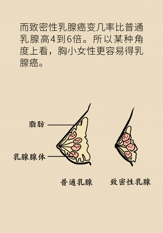 胸小就不會得乳腺癌嗎？醫(yī)生：患病概率更高