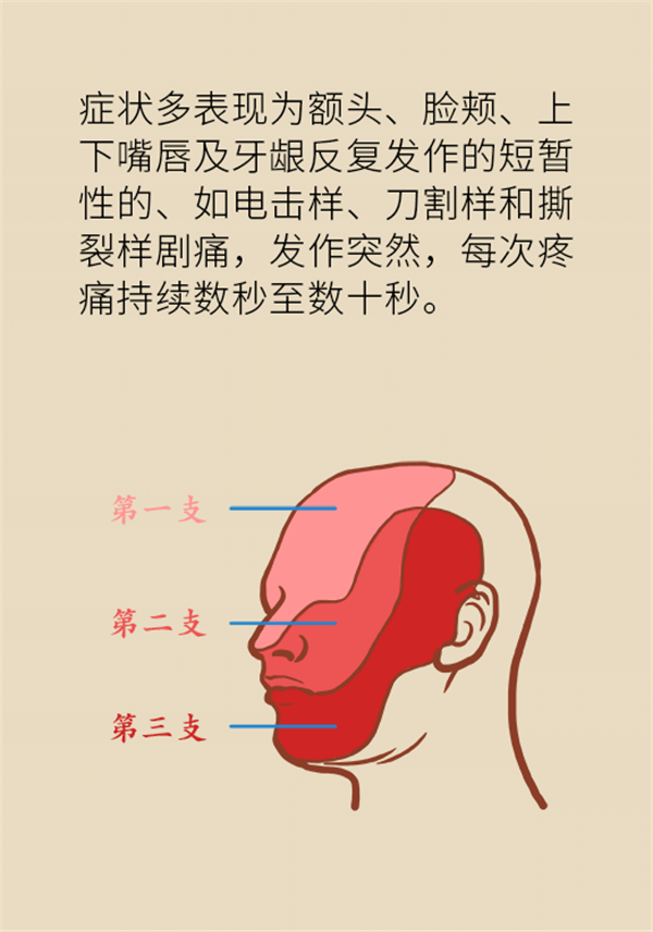 這種疼痛不是牙疼？緩解三叉神經(jīng)痛就用這兩招