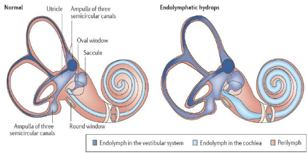 “耳水不平衡”是什么??？